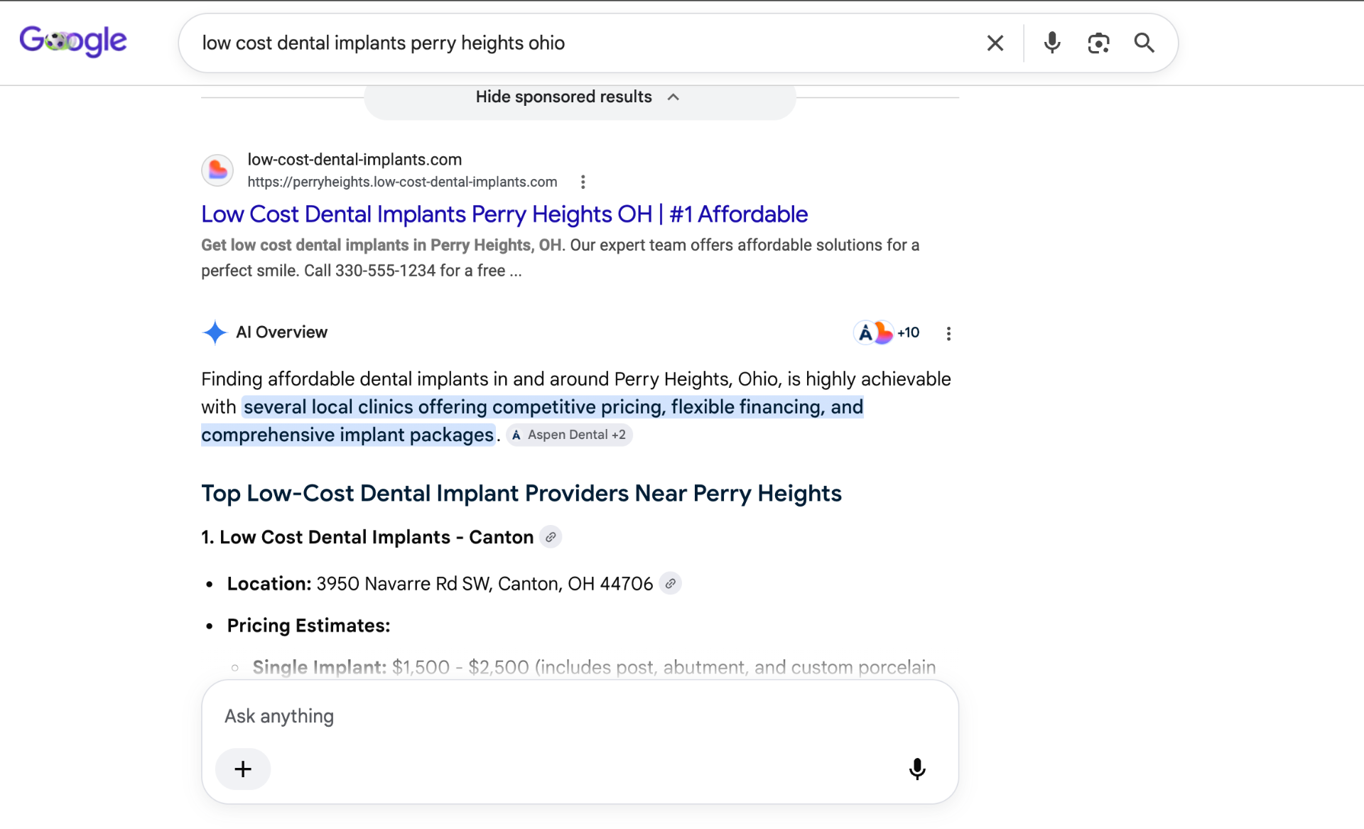 Google search results for low cost dental implants perry heights ohio